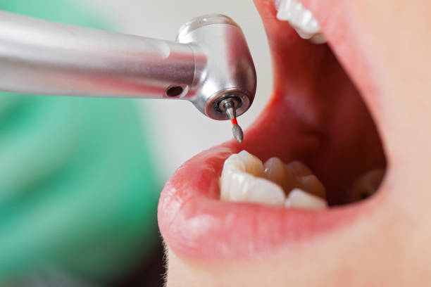 Best Emergency Cosmetic Dentistry (e.g., broken veneers) in Oswego, IL